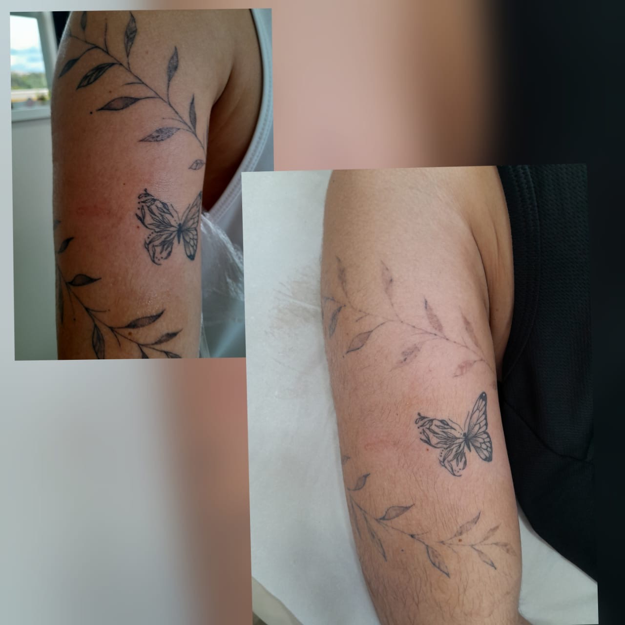 remocao-tatuagem-laser-patricia-cardoso-03
